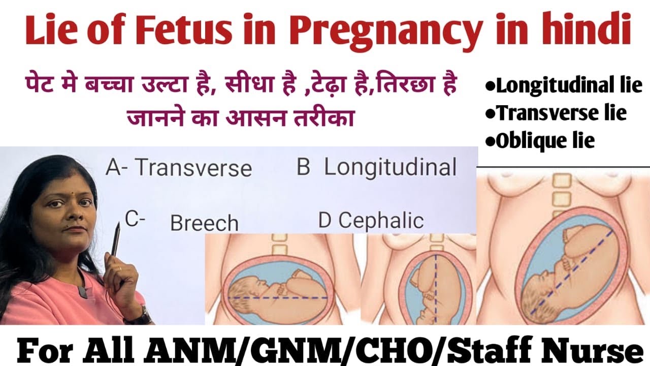 What is Lie of fetus during pregnancy in hindi with question by Ranjana Rock Nursing