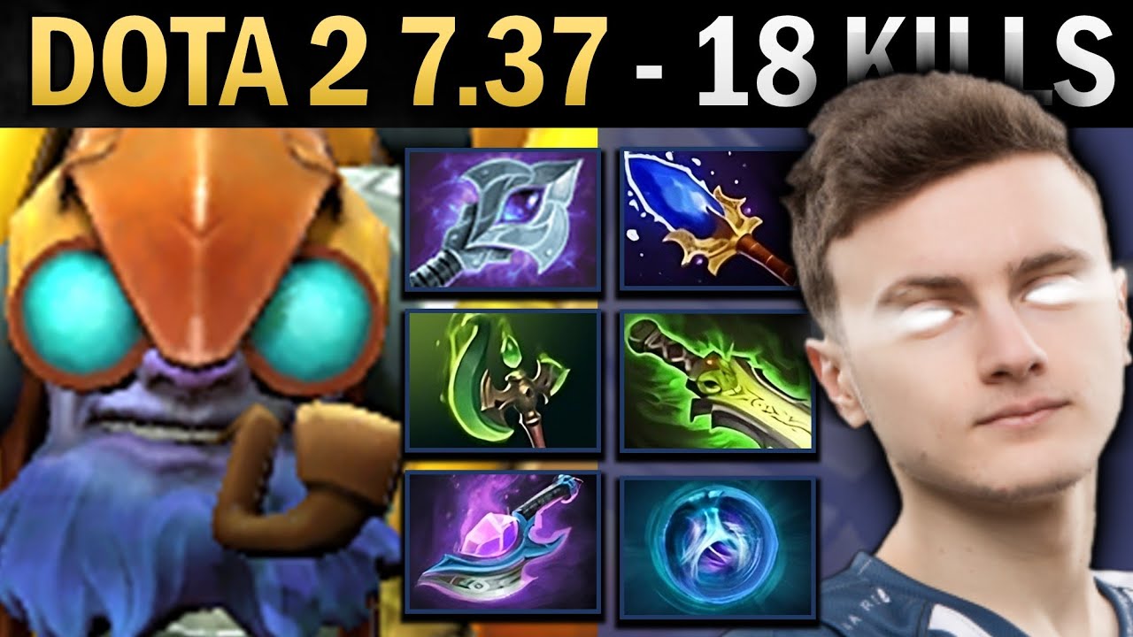 Tinker Gameplay Miracle with 17 Kills and Parasma - Dota 2 7.37