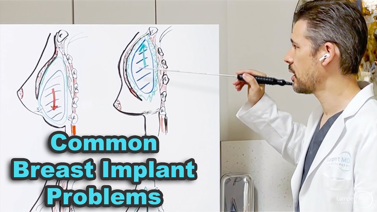 Common Breast Implant Problems