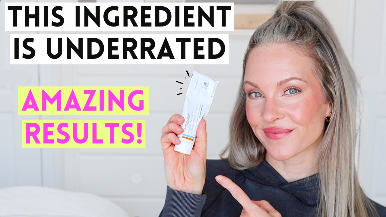 AZELAIC ACID IS UNDERRATED! THIS SKINCARE INGREDIENT HAS REALLY IMPROVED MY REDNESS & ACNE!