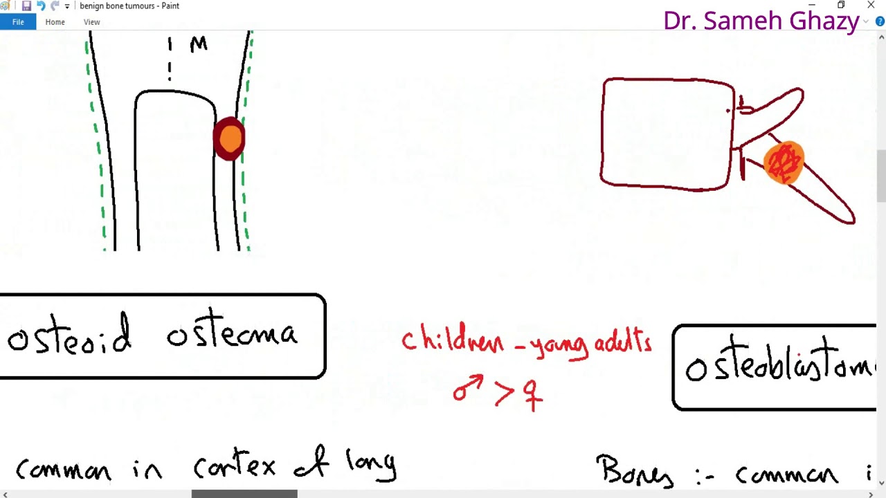 Systemic pathology 33 : bone 3 ( benign bone tumors )   DR.SAMEH GHAZY