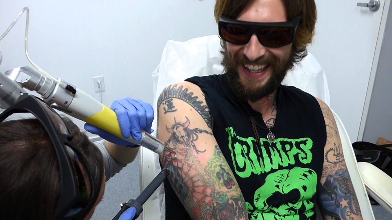 Tattoo Artist Gets Almost All His Tattoos Lasered Off