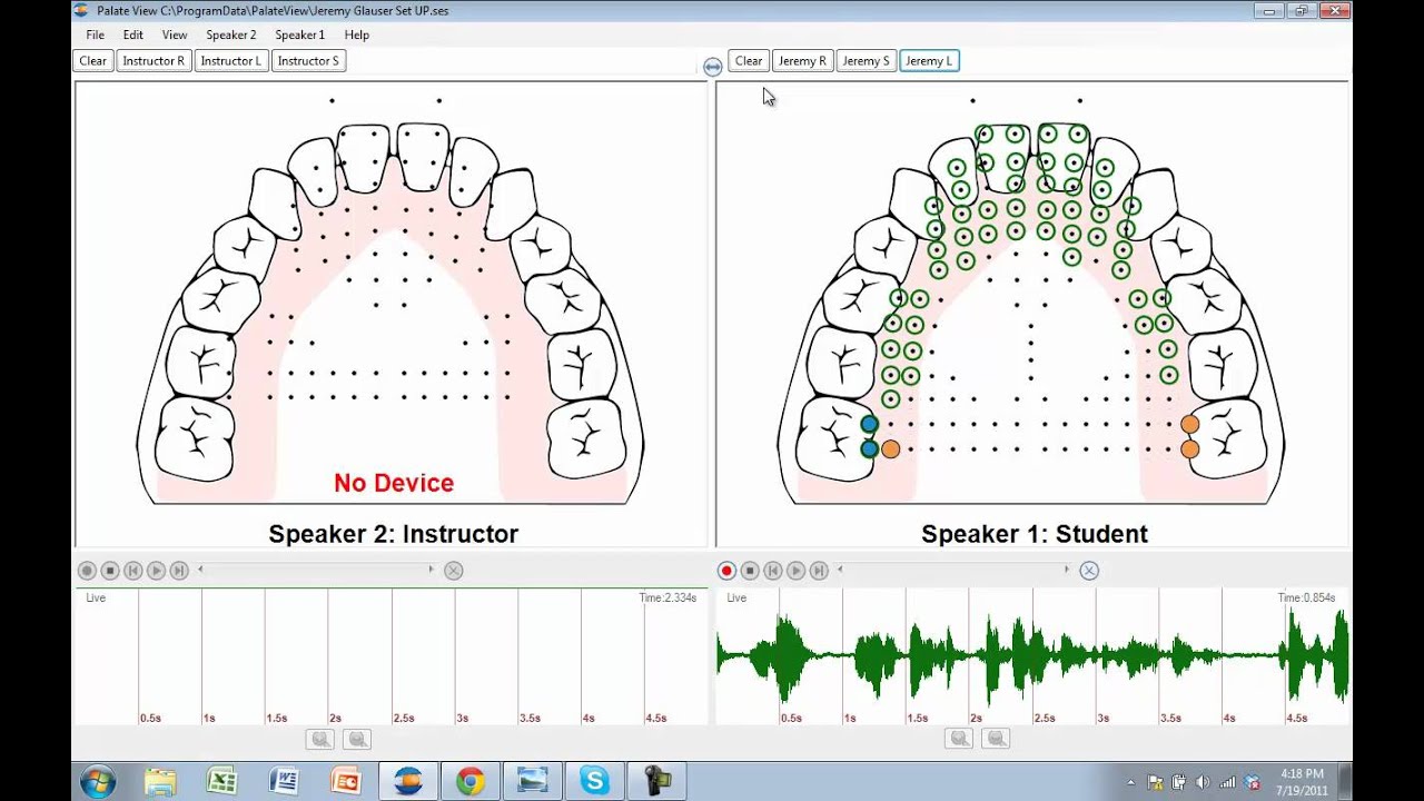 SmartPalate (EPG) System Demo