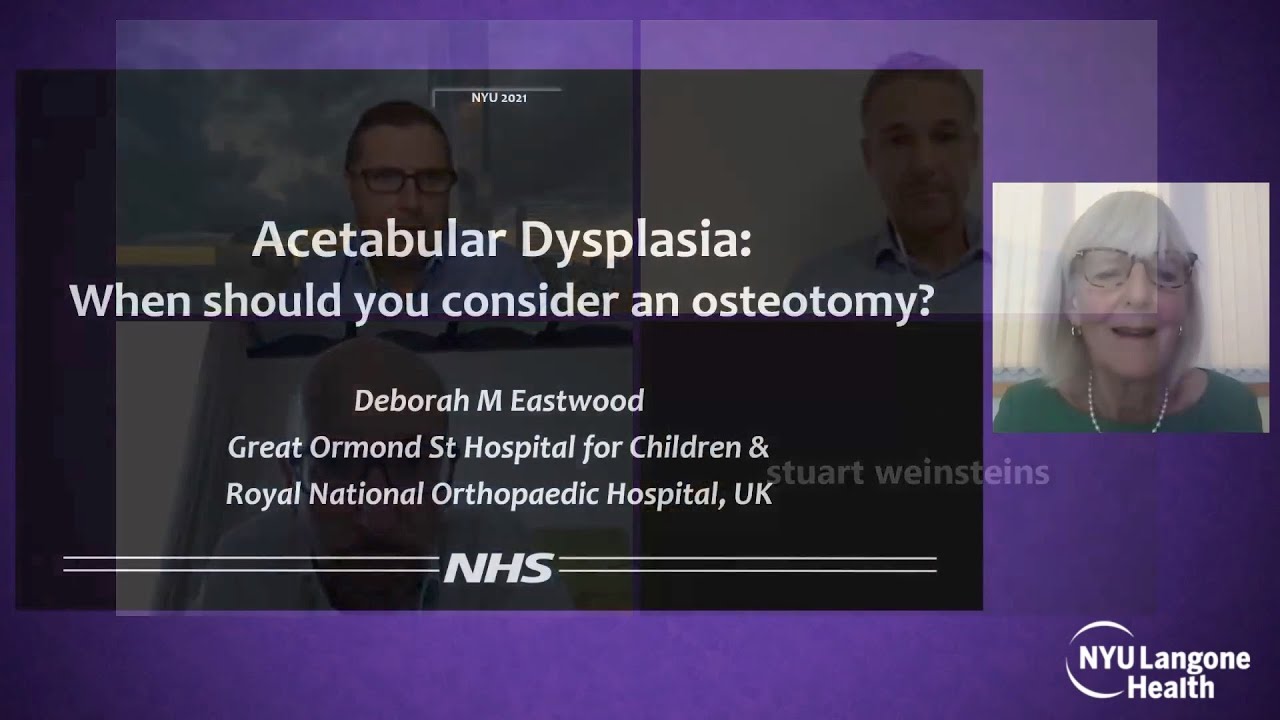 Acetabular Dysplasia - When Should You Consider an Osteotomy - International Hip Dysplasia Symposium