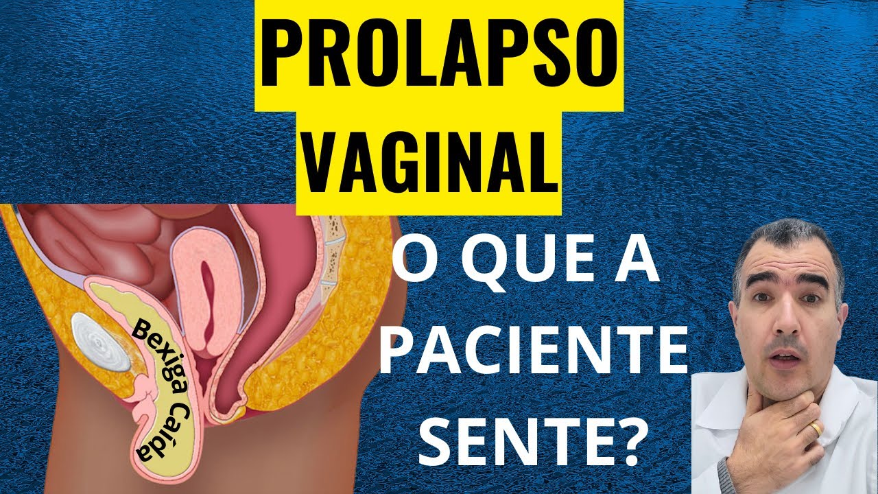 Prolapso vaginal: como a paciente percebe esse problema