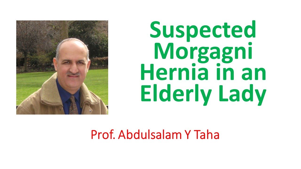 Suspected Morgagni Hernia in an Elderly Lady