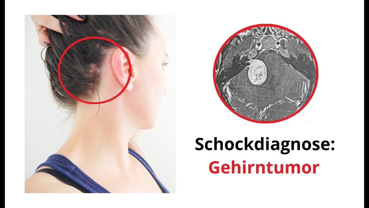 Schockdiagnose: Gehirntumor