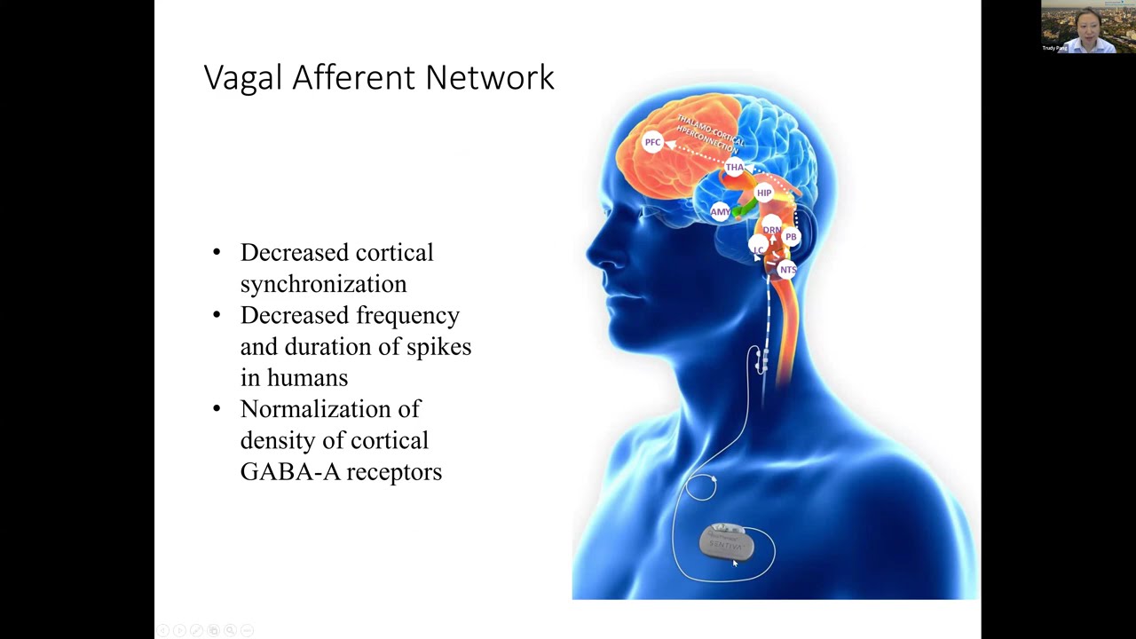 Wednesday Webinar: Vagus Nerve Stimulation (VNS) Therapy