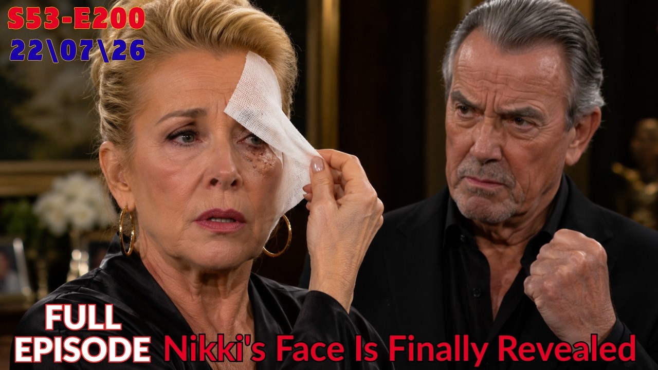Y&R Full Episode: Nikki's Face Is Finally Revealed&hellip; Victor's Explosive Vow Changes Everything!