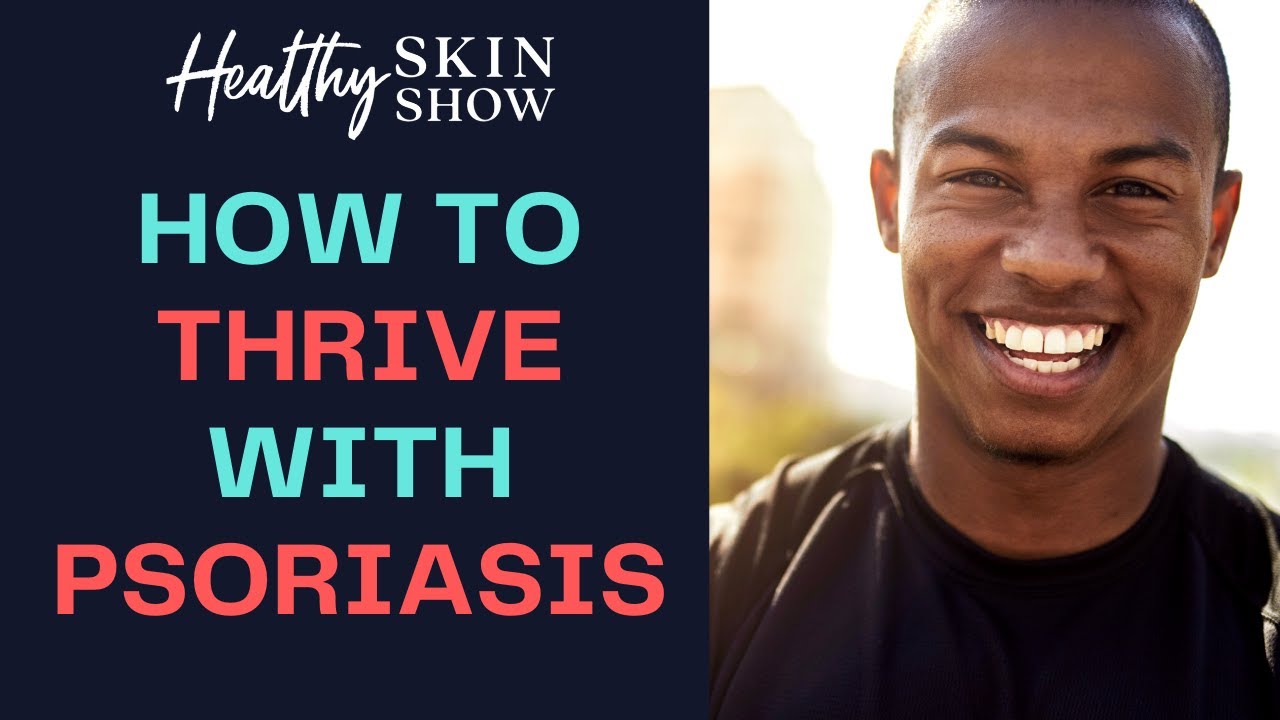 How to THRIVE With Psoriasis | Reena (aka @Psoriaris_Thoughts)