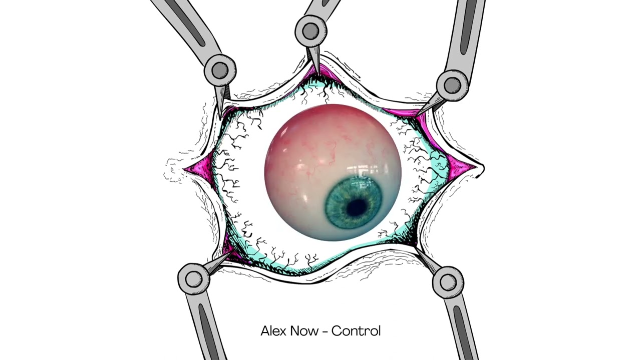Alex Now (ES) - Control