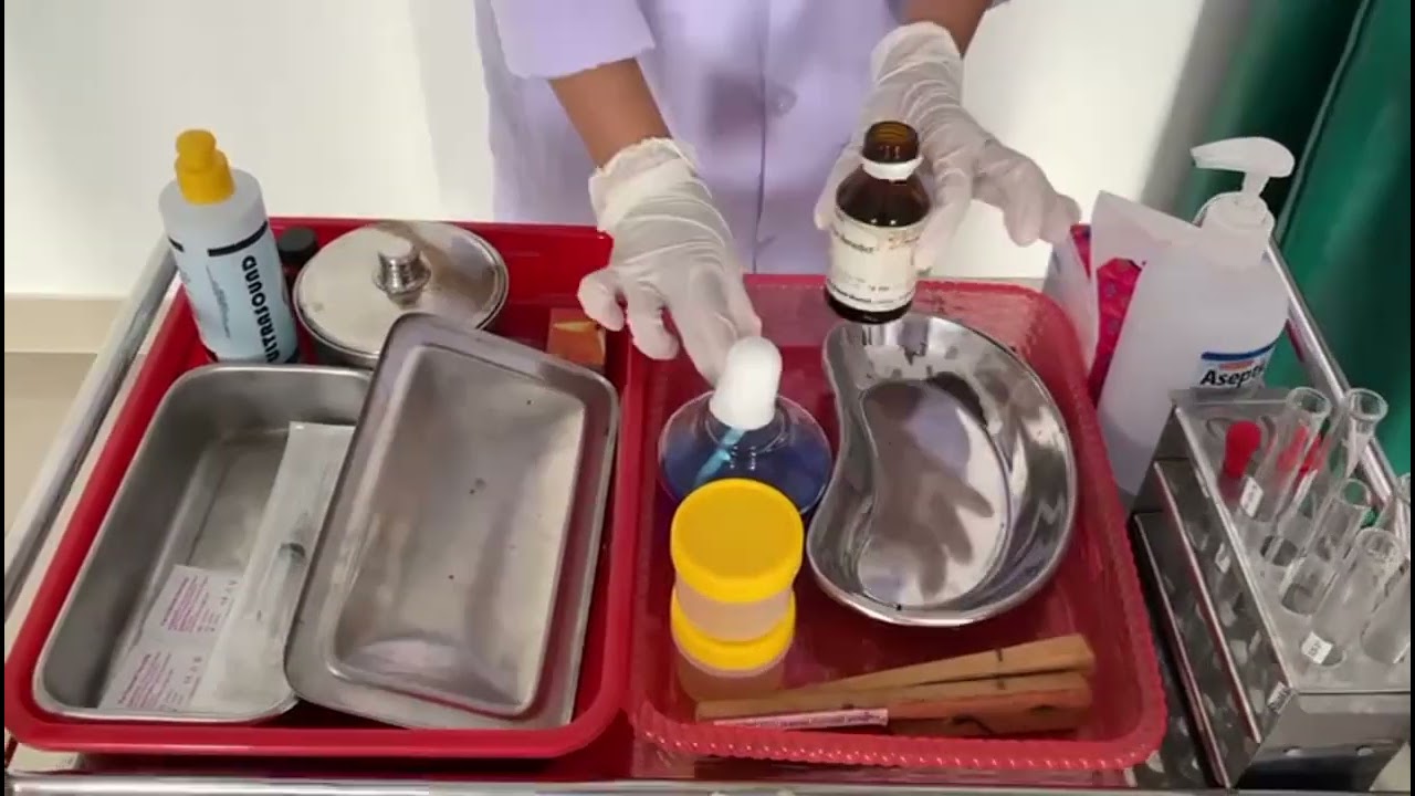 Pengecekan Glukosa Urine 