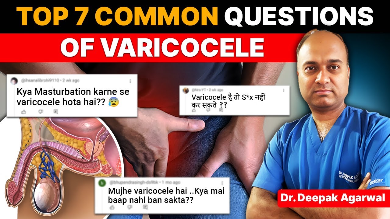 क्या Masturbation से Varicocele होता है? | Top 7 Common Varicocele Questions | Dr Deepak Agarwal IR