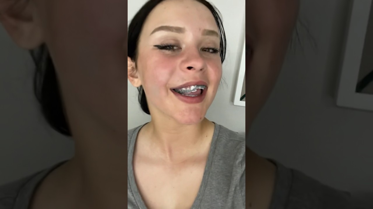 Her Braces May Have SAVED Her Teeth! 😬🦷