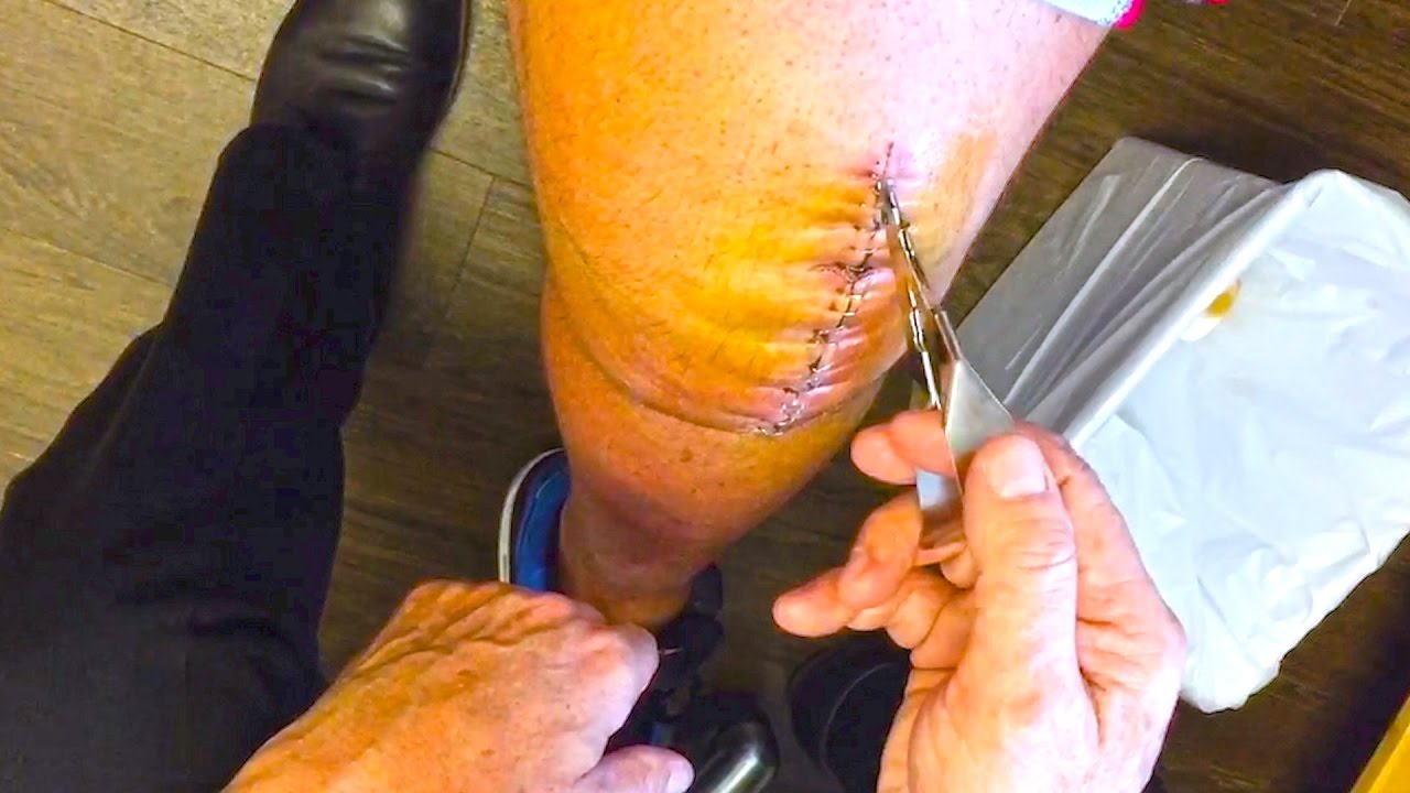 REBUILDING RON - Staples Out! [Part 2]
