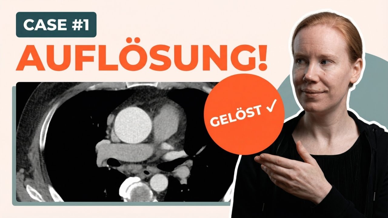 CTA Aorta: Axial messen war gestern – Das ist der richtige Weg! Auflösung 