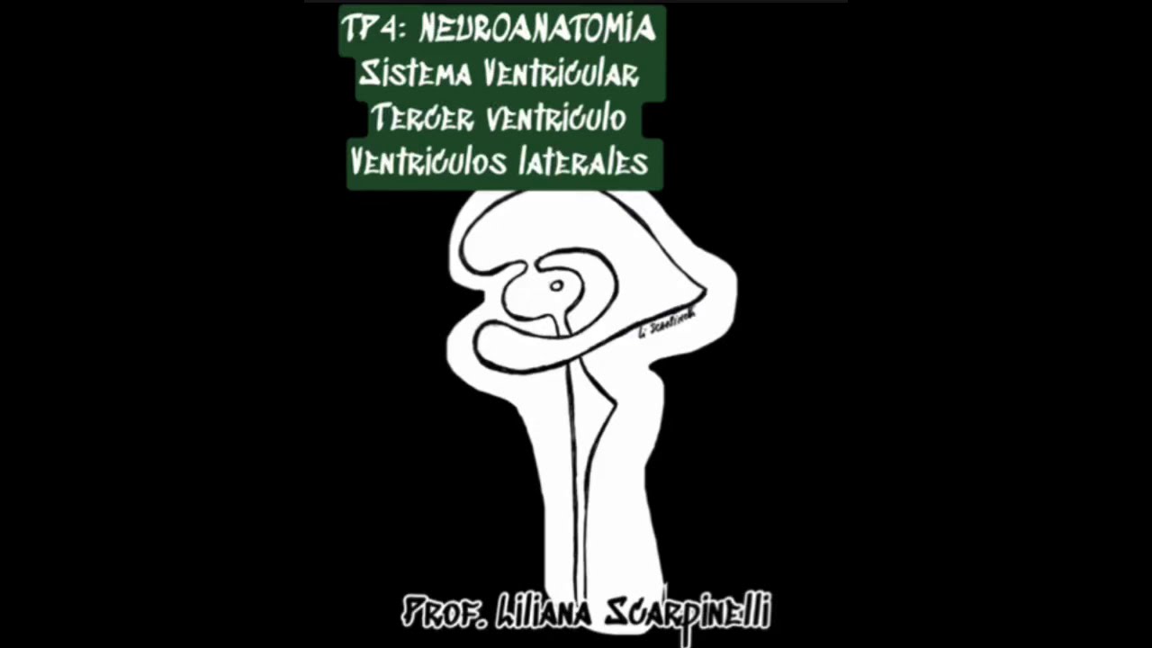 Neuroanatomia Tp4: Sistema ventricular: Ventrículos laterales y Tercer ventrículo
