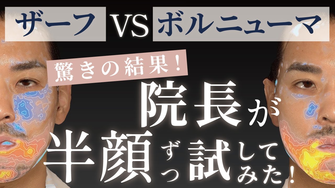 人気の高周波はどんな違いが出る⁉️半顔実験で驚きの違いが💡【XERF】【ボルニューマ】