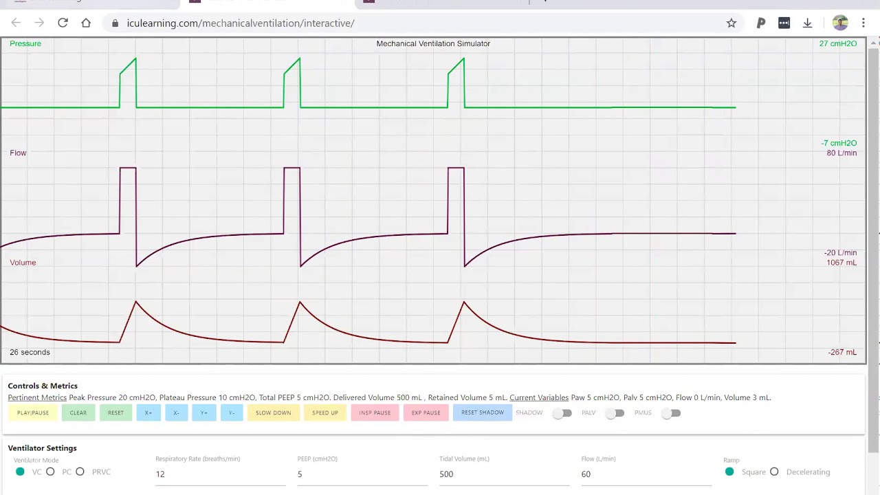 Diagnosing Air Trapping or Auto PEEP
