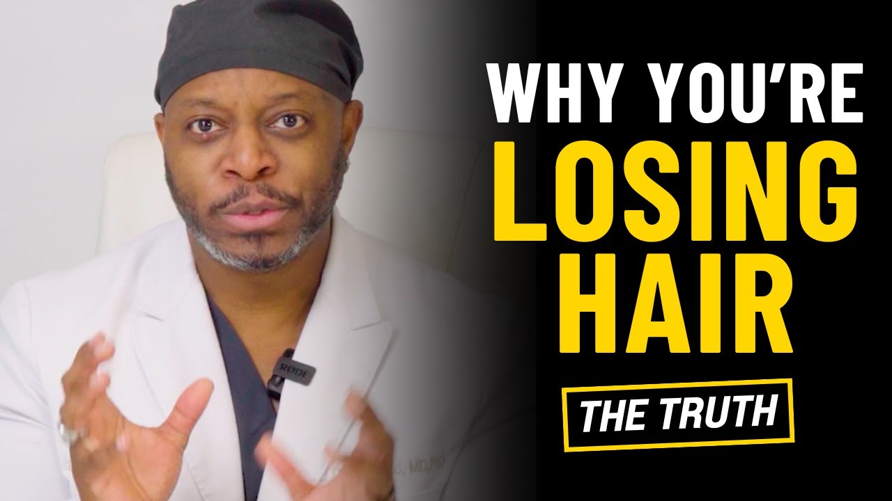 Why Men Lose Hair (The Truth No One Explains)
