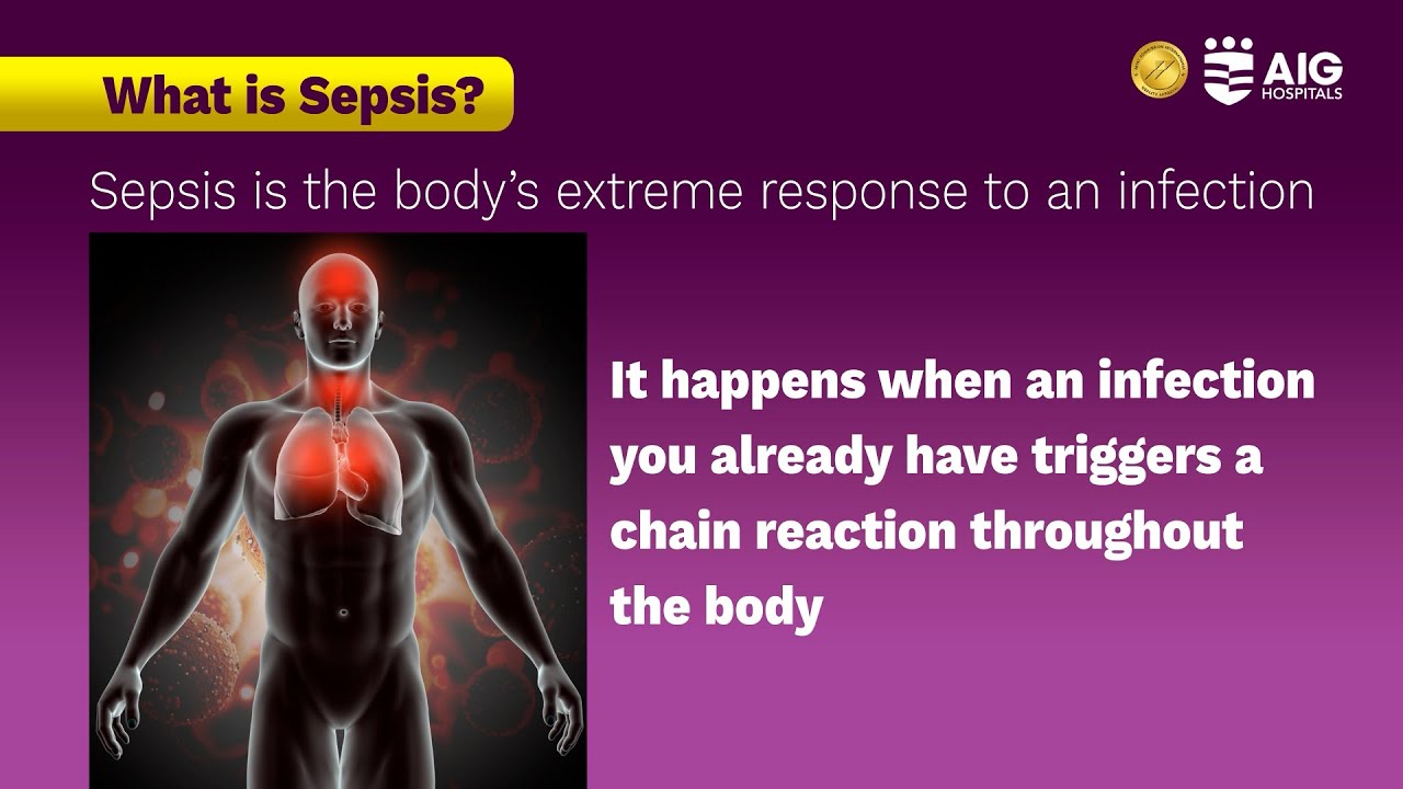 World Sepsis Day 2025 | AIG Hospitals
