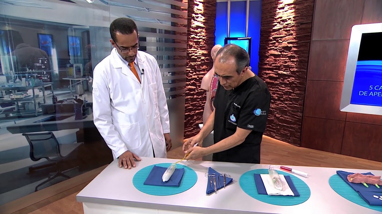 APENDICITIS - HACIA UN NUEVO ESTILO DE VIDA