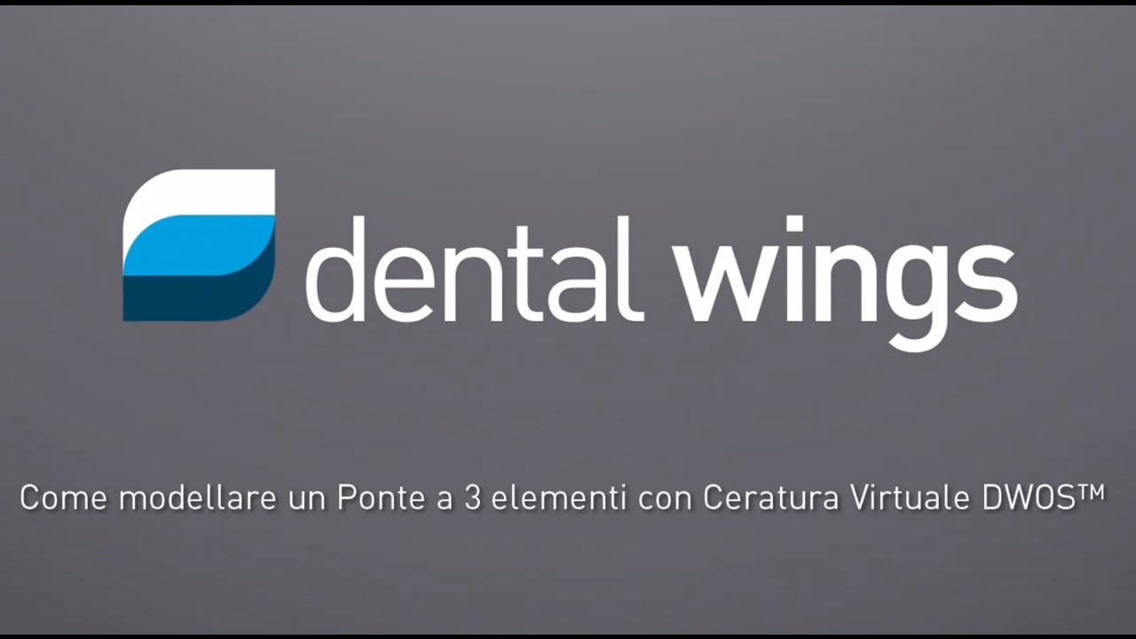 Come Modellare un Ponte a 3 elementi con Ceratura Virtuale DWOS™