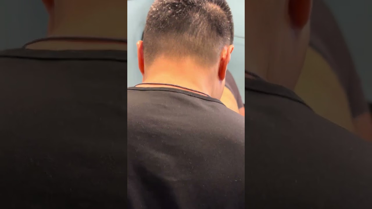 Patient With Lower Back Pain.