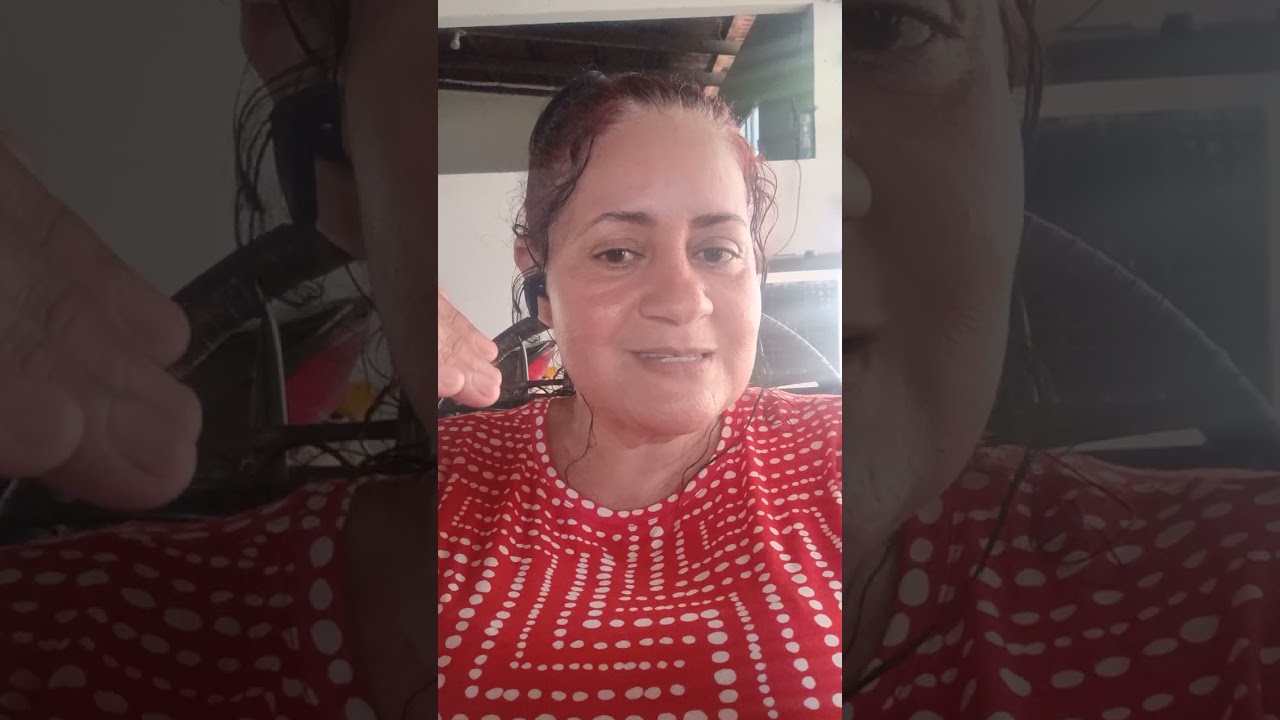 Nanda ainda tem muitas estereotipias , sensibilidade no couro cabeludo e braços 