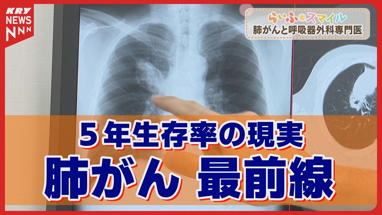 肺がんとどう向き合う？専門医が語る最新手術と早期発見の重要性【徳山中央病院】