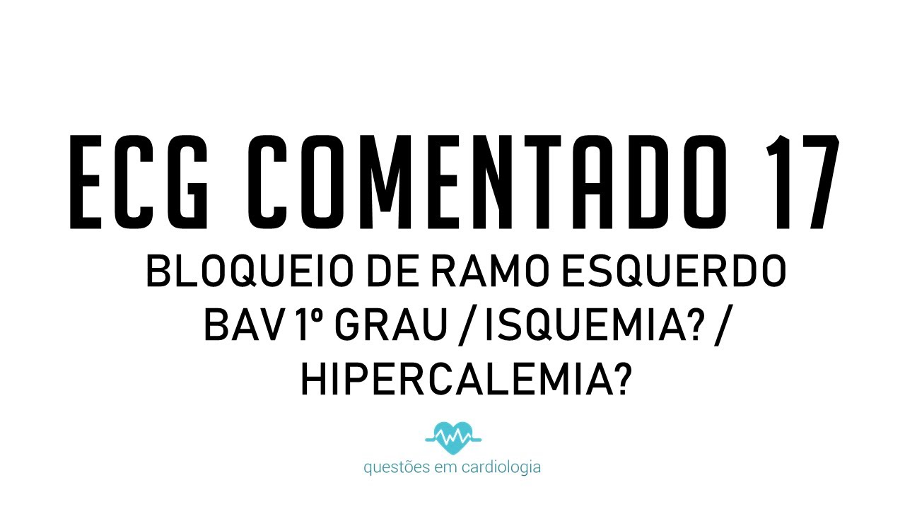 ECG Comentado 17 - BRE / BAV 1° grau / Isquemia? / Hipercalemia?
