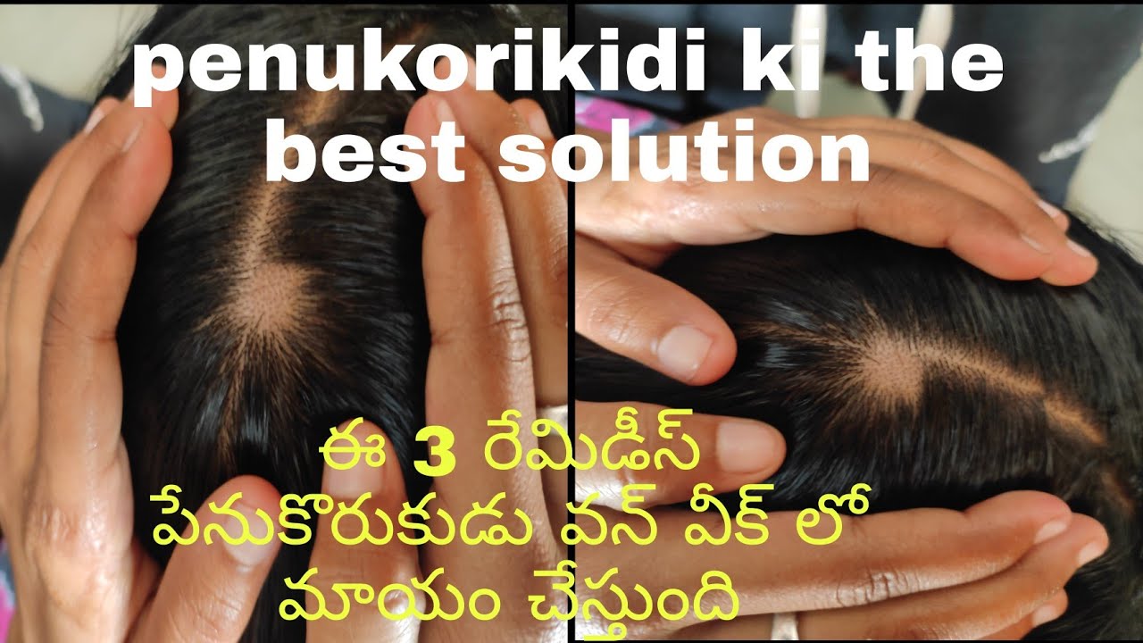 penukorikidi and hair growth ki the best solution రెండు విధాల మేలు చేసే రేమిడీస్