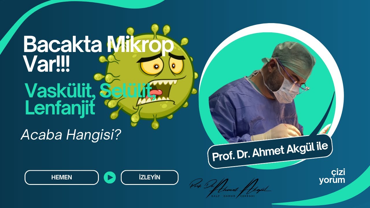 Bacak Şişliği, Kızarıklık ve Ağrı: Vaskülit mi, Selülit mi, Lenfanjit mi? | Prof. Dr. Ahmet Akgül