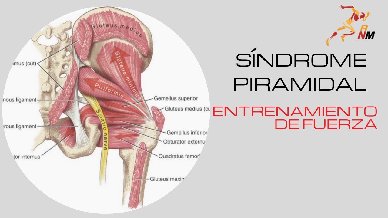 Síndrome Piramidal y Entrenamiento de Fuerza