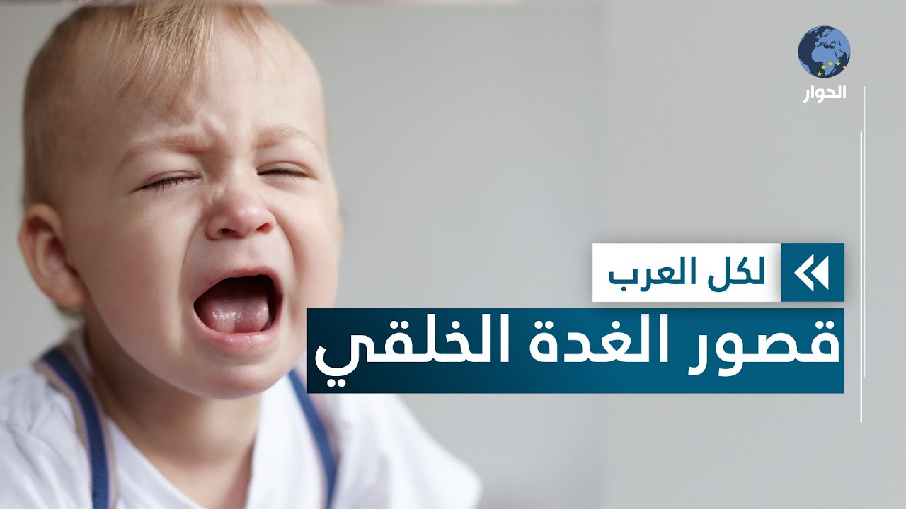 ما هو قصور الغدة الدرقية الخلقي لدى الأطفال وما هي أعراضه؟