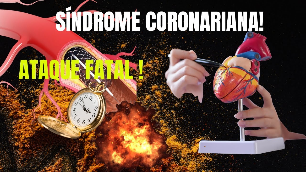 Quiz de Síndrome Coronariana: Você Reconhece o Ataque Mortal?