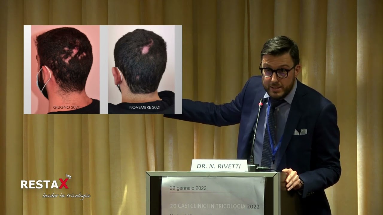 Caso Clinico N°5 Dr. Nicolò Rivetti -20 CASI CLINICI IN TRICOLOGIA 2022