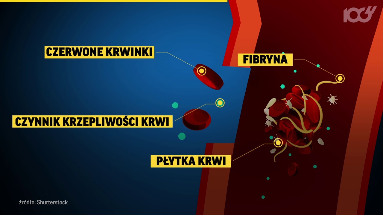 W jaki sposób krzepnie krew? | Onet100
