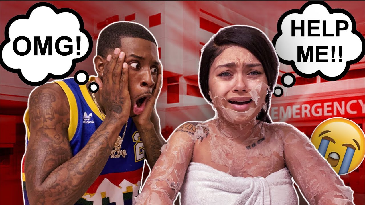 Disgusting Peel Skin Prank On Boyfriend!! **He Freaked Out**