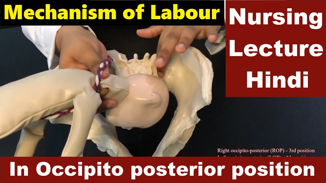 Mechanism of Labour in Occipito posterior position in Hindi (हिंदी) | Nursing Lecture