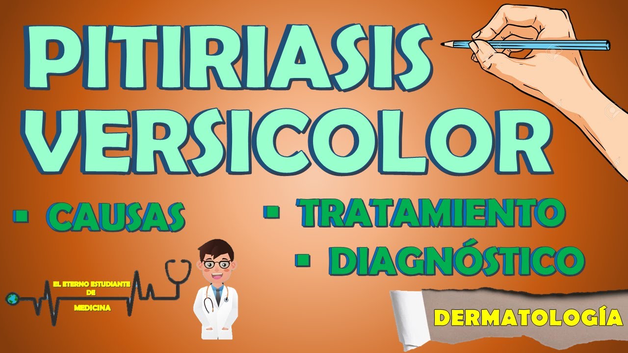 PITIRIASIS VERSICOLOR TRATAMIENTO Y CAUSAS | Diagnóstico - Diagnóstico diferencial 📝👨🏻‍⚕️
