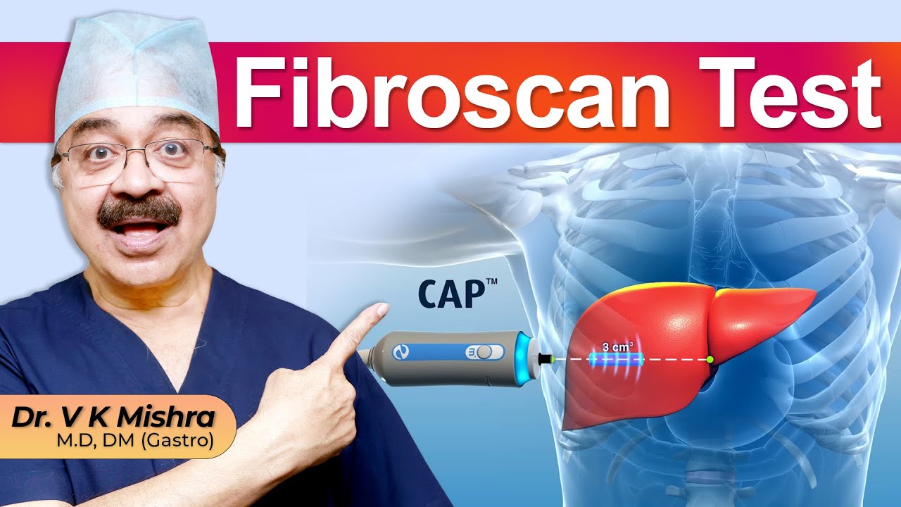 कैसे की जाती है Fibroscan Test ||  HOW FIBROSCAN TEST WORKS