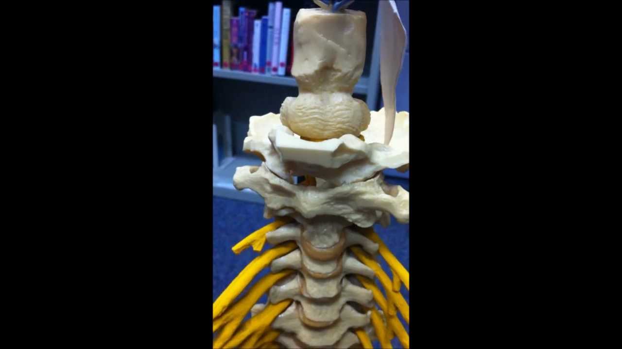 Quick Demonstration of C1-C2 Instability in Ehlers-Danlos