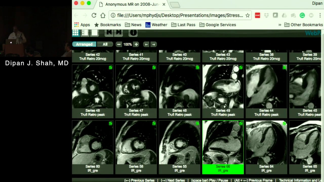 Stress MRI: Methodology, Current Role and Case Studies (Dipan Shah, MD) December 13, 2016