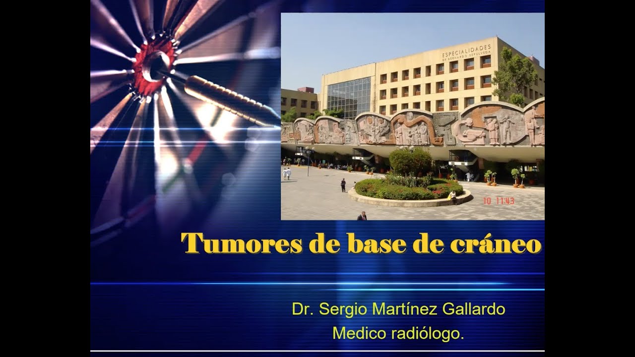 1-4 Tumores de la Base de Cráneo | Dr. Martinez