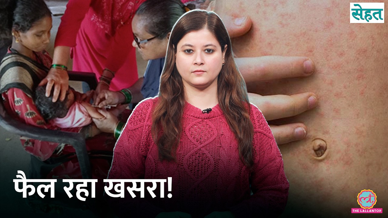 India समेत दुनियाभर में बढ़ रहे Measles के मामले, डॉक्टर से जानिए कैसे बचें? | Sehat Ep. 1307