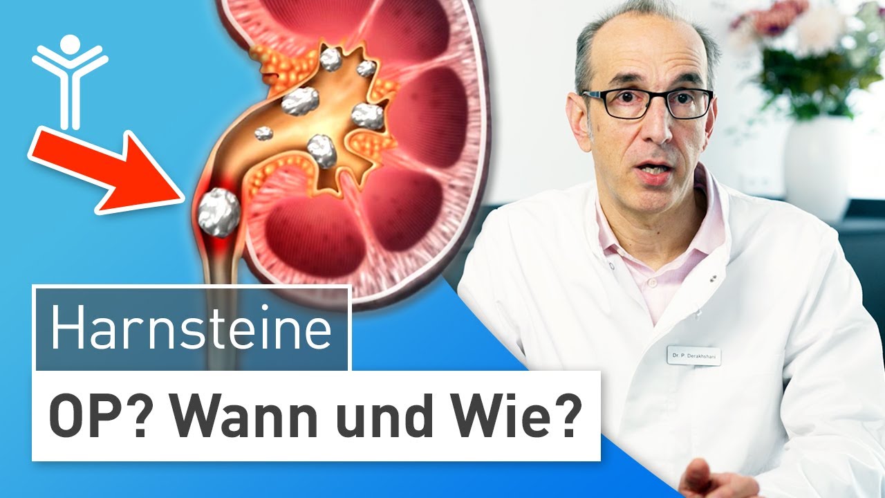 Harnsteine entfernen: WANN und WIE operieren? | Nierensteine