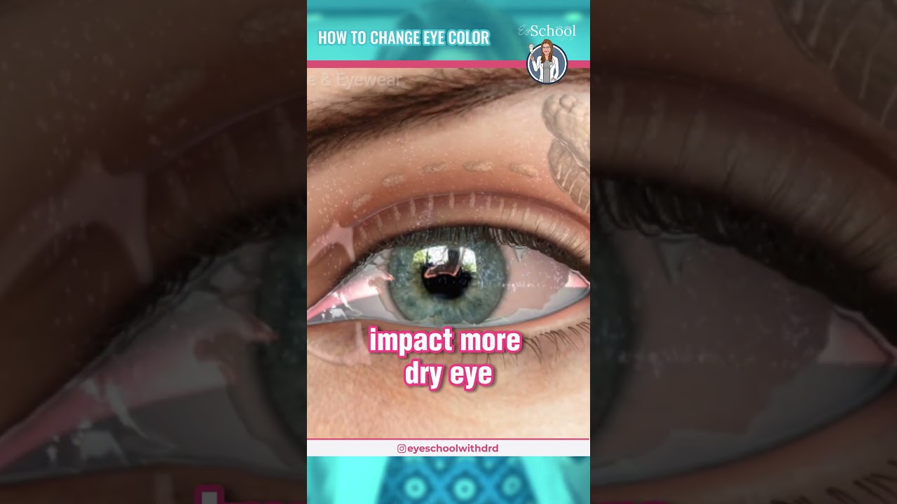 Changing color of Eyes