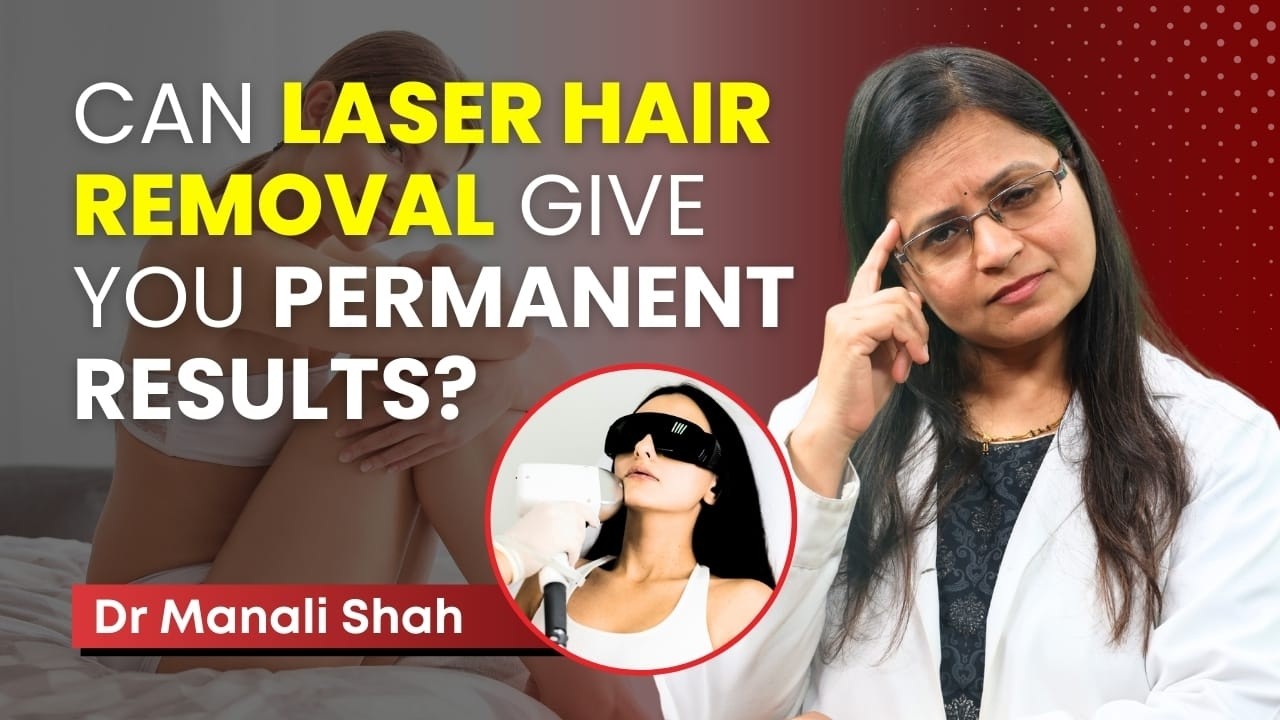 क्या Laser Hair Removal एक permanent solution है? | Permanent Hair Removal or Not? | Clear Skin