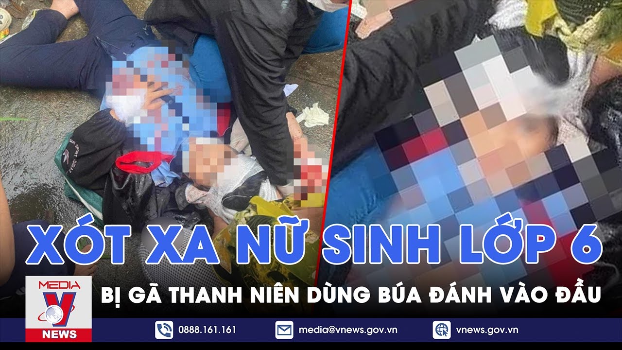 Tin tối ngày 25/10. Xót xa nữ sinh lớp 6 bị gã thanh niên dùng búa đánh vào đầu, liệt nửa người phải